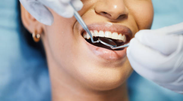 Best Urgent Tooth Repair  in Frankfort, KY